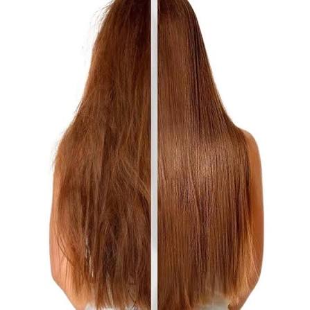 Beautox treatment